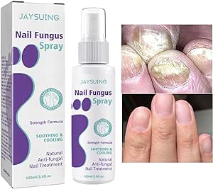 Revitalizing Nail Fungus Solution - pukhtoon.shop